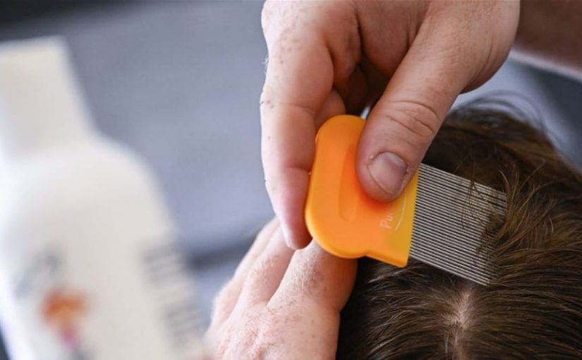 كيف تكتشفين القمل في مراحله الأولى؟ دليل للأمهات خطوة بخطوة